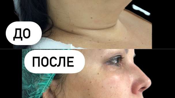 Trichologist-Cosmetologist Batumi "Clinic Elite"