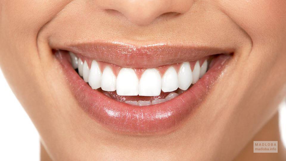 Белоснежная улыбка от стоматологии Адента