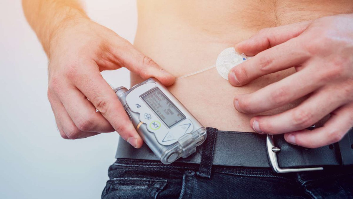 უახლესი კვლევები და ტექნოლოგიები დიაბეტის მკურნალობაში