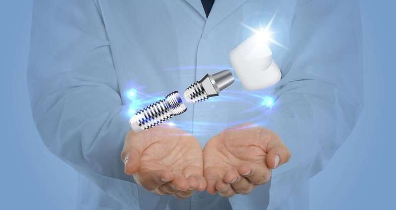 dentist with an implant