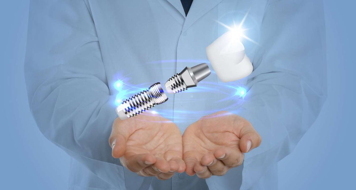 Стоматолог с имплантом