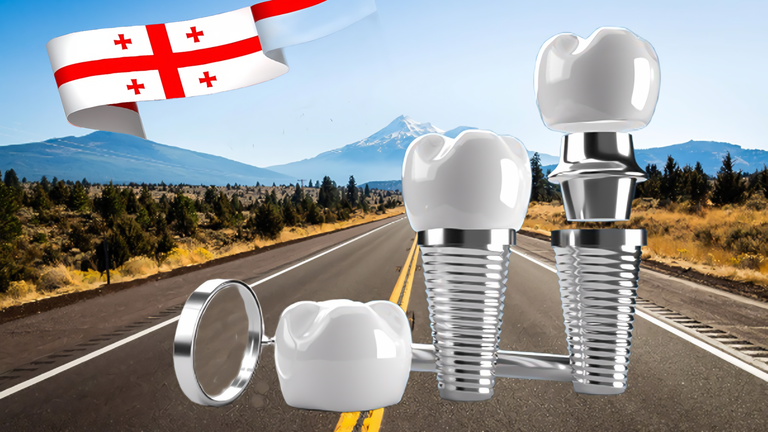 Dental Tourism in Georgia: Its Advantages and Features