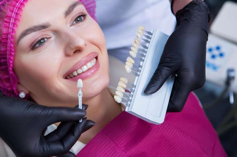 installation of dental veneers