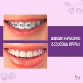 ელიზ ესთეტიკსი