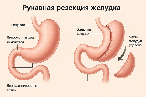 stomach